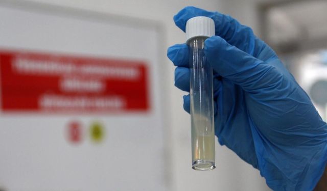 Tüberküloz Hastalarına Yakın Takip